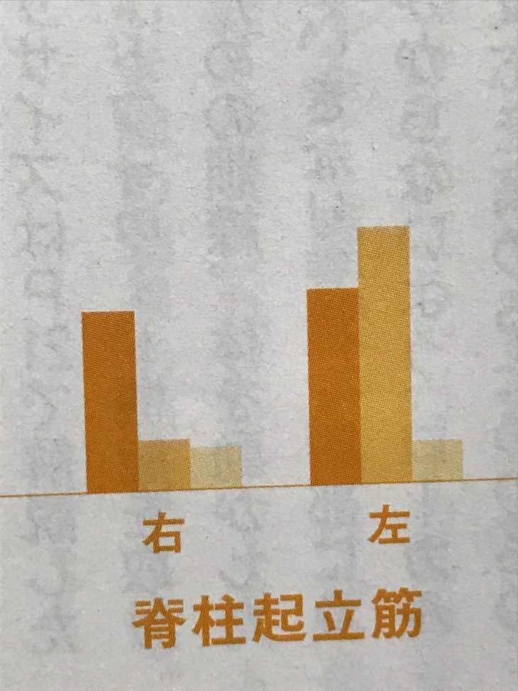 脊柱起立筋活動