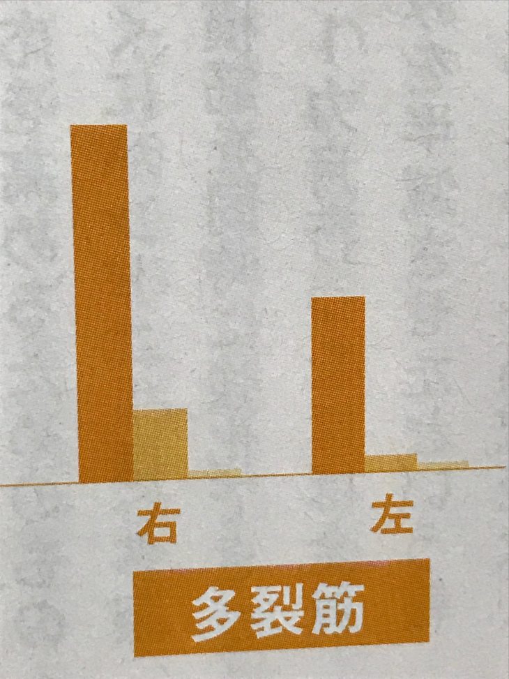 多裂筋活動